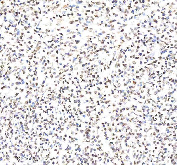 m14495 2 hist1h4a primary antibodies ihc testing 11