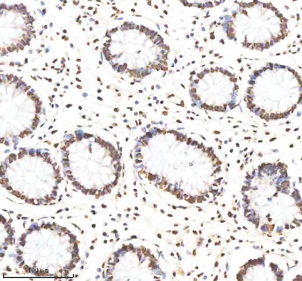 m14495 2 hist1h4a primary antibodies ihc testing 12
