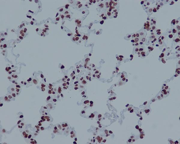 m14495 3 ihc