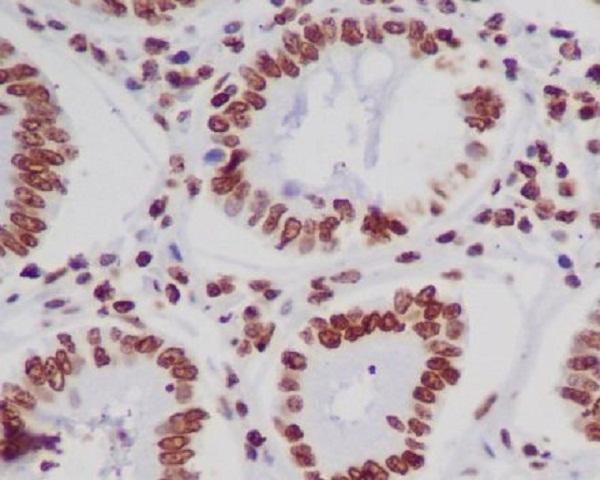 m14495 4 ihc