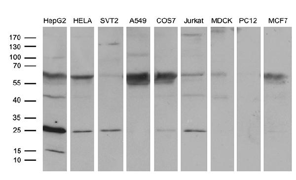 Western blot analysis of extracts (35ug) from 9 different cell lines by using anti-TCEANC2 monoclonal antibody (HepG2: human; HeLa: human; SVT2: mouse; A549: human; COS7: monkey; Jurkat: human; MDCK: canine; PC12: rat; MCF7: human) (1:500). Western blot analysis of extracts (35ug) from 9 different cell lines by using anti-TCEANC2 monoclonal antibody (HepG2: human; HeLa: human; SVT2: mouse; A549: human; COS7: monkey; Jurkat: human; MDCK: canine; PC12: rat; MCF7: human) (1:500).