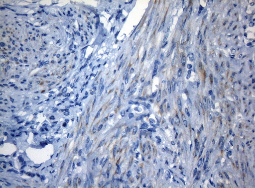 Immunohistochemical staining of paraffin-embedded Human endometrium tissue within the normal limits using anti-ZNF394 mouse monoclonal antibody. (Heat-induced epitope retrieval by 1mM EDTA in 10mM Tris buffer (pH8.5) at 120°C for 3min