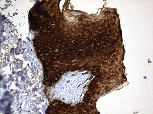 m14544 anti krt84 mouse monoclonal antibody clone id oti2d1 ihc testing 2