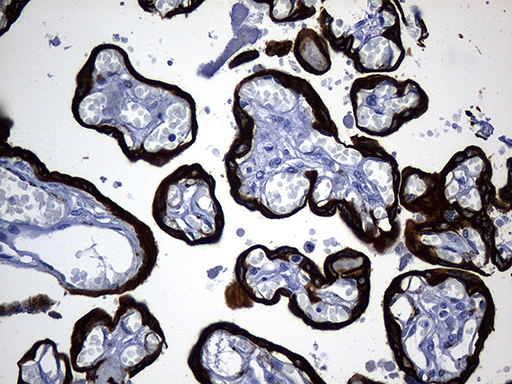 m14544 anti krt84 mouse monoclonal antibody clone id oti2d1 ihc testing 3