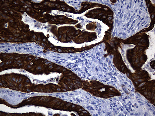 m14544 anti krt84 mouse monoclonal antibody clone id oti2d1 ihc testing 5