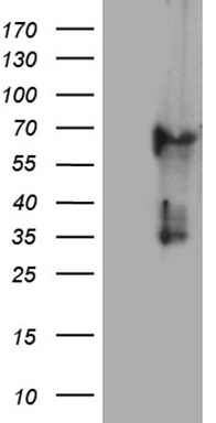 m14544 anti krt84 mouse monoclonal antibody clone id oti2d1 wb testing 1