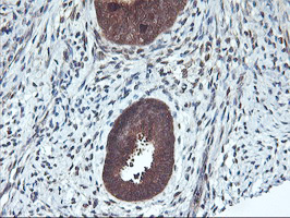 Immunohistochemical staining of paraffin-embedded Human endometrium tissue within the normal limits using anti-RABL2A mouse monoclonal antibody