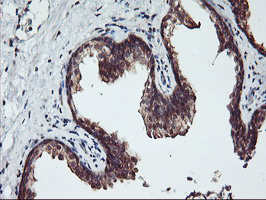 m14567 1 anti rabl2a mouse monoclonal antibody clone id oti5a10 ihc testing 5