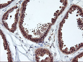m14567 1 anti rabl2a mouse monoclonal antibody clone id oti5a10 ihc testing 6