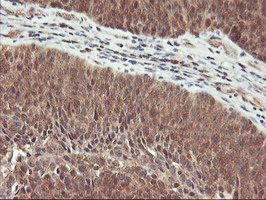 m14567 1 anti rabl2a mouse monoclonal antibody clone id oti5a10 ihc testing 7