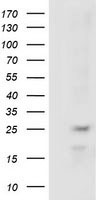 HEK293T cells were transfected with the pCMV6-ENTRY control (Left lane) or pCMV6-ENTRY RABL2A (Right lane) cDNA for 48 hrs and lysed