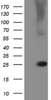 HEK293T cells were transfected with the pCMV6-ENTRY control (Left lane) or pCMV6-ENTRY RABL2A (Right lane) cDNA for 48 hrs and lysed