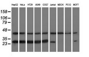 Western blot analysis of extracts (35ug) from 9 different cell lines by using anti-RABL2A monoclonal antibody