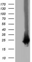 HEK293T cells were transfected with the pCMV6-ENTRY control (Left lane) or pCMV6-ENTRY RABL2A (Right lane) cDNA for 48 hrs and lysed