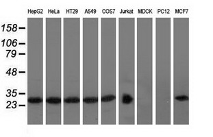 Western blot analysis of extracts (35ug) from 9 different cell lines by using anti-RABL2A monoclonal antibody