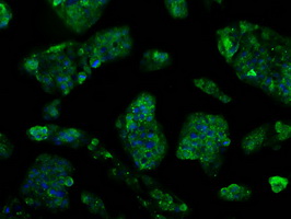 m14589 anti ttll12 mouse monoclonal antibody clone id oti4b2 if testing 21