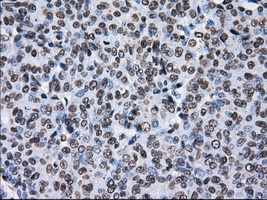 m14589 anti ttll12 mouse monoclonal antibody clone id oti4b2 ihc testing 9