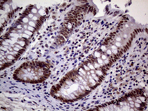 Immunohistochemical staining of paraffin-embedded Human colon tissue within the normal limits using anti-MAGEB4 mouse monoclonal antibody