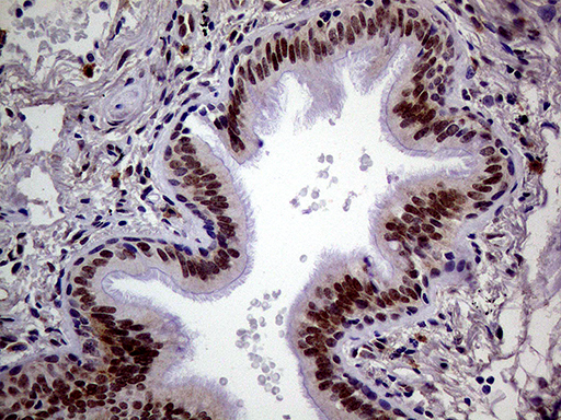 m14698 1 anti mageb4 mouse monoclonal antibody clone id oti3h2 ihc testing 4