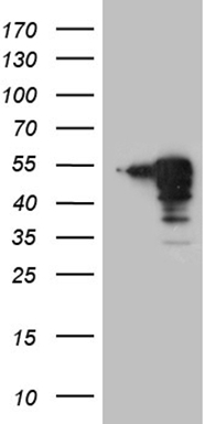 HEK293T cells were transfected with the pCMV6-ENTRY control (Left lane) or pCMV6-ENTRY MAGEB4 (Right lane) cDNA for 48 hrs and lysed