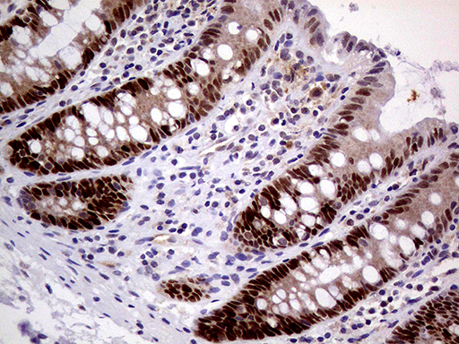m14698 anti mageb4 mouse monoclonal antibody clone id oti1b5 ihc testing 4