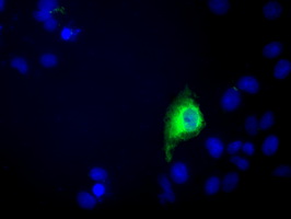 m14721 2 anti c9orf41 carnmt1 mouse monoclonal antibody clone id oti6e4 if testing 5