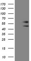HEK293T cells were transfected with the pCMV6-ENTRY control (Left lane) or pCMV6-ENTRY C9orf41 (Right lane) cDNA for 48 hrs and lysed