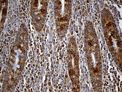 Immunohistochemical staining of paraffin-embedded Human appendix tissue within the normal limits using anti-FAM54A mouse monoclonal antibody