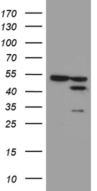 HEK293T cells were transfected with the pCMV6-ENTRY control (Left lane) or pCMV6-ENTRY FAM54A (Right lane) cDNA for 48 hrs and lysed