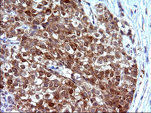 m14759 1 anti cox4nb emc8 mouse monoclonal antibody clone id oti1d6 ihc testing 14