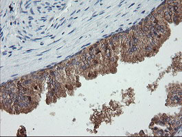 Immunohistochemical staining of paraffin-embedded Human prostate tissue within the normal limits using anti-C2orf62 mouse monoclonal antibody