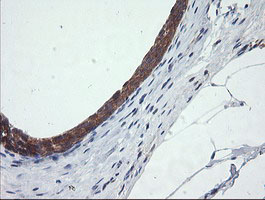 m14789 anti catip mouse monoclonal antibody clone id oti4b4 ihc testing 5