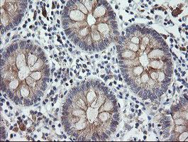 m14789 anti catip mouse monoclonal antibody clone id oti4b4 ihc testing 6