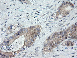 m14789 anti catip mouse monoclonal antibody clone id oti4b4 ihc testing 7