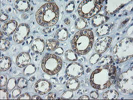 m14789 anti catip mouse monoclonal antibody clone id oti4b4 ihc testing 8