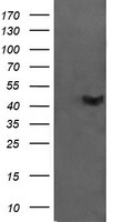 HEK293T cells were transfected with the pCMV6-ENTRY control (Left lane) or pCMV6-ENTRY C2orf62 (Right lane) cDNA for 48 hrs and lysed