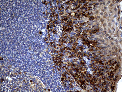 Immunohistochemical staining of paraffin-embedded Human tonsil within the normal limits using anti-PPP4R4 mouse monoclonal antibody