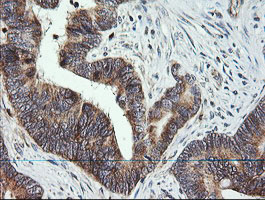 m14945 anti mrps34 mouse monoclonal antibody clone id oti4h2 ihc testing 10