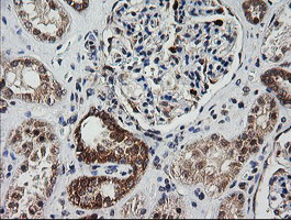m14945 anti mrps34 mouse monoclonal antibody clone id oti4h2 ihc testing 11