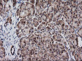 m14945 anti mrps34 mouse monoclonal antibody clone id oti4h2 ihc testing 4