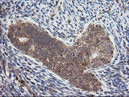 m14945 anti mrps34 mouse monoclonal antibody clone id oti4h2 ihc testing 6