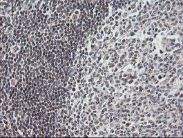 m14945 anti mrps34 mouse monoclonal antibody clone id oti4h2 ihc testing 8