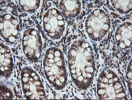m14945 anti mrps34 mouse monoclonal antibody clone id oti4h2 ihc testing 9
