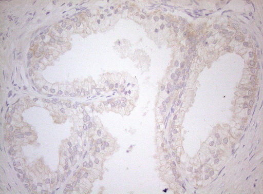 Immunohistochemical staining of paraffin-embedded Human prostate tissue within the normal limits using anti-MXD4 mouse monoclonal antibody