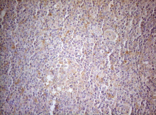 m14953 anti mad4 mxd4 mouse monoclonal antibody clone id oti7f7 ihc testing 5