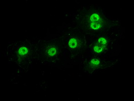 m14965 anti protein kinase y linked prky mouse monoclonal antibody clone id oti3e10 if testing 15