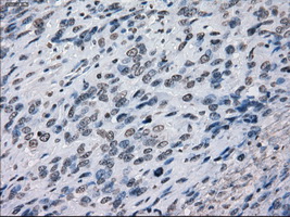 m14965 anti protein kinase y linked prky mouse monoclonal antibody clone id oti3e10 ihc testing 10