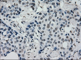 m14965 anti protein kinase y linked prky mouse monoclonal antibody clone id oti3e10 ihc testing 11