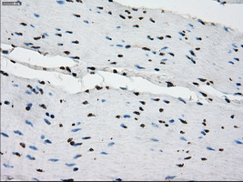 m14965 anti protein kinase y linked prky mouse monoclonal antibody clone id oti3e10 ihc testing 12