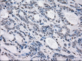 m14965 anti protein kinase y linked prky mouse monoclonal antibody clone id oti3e10 ihc testing 13